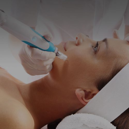 Dermapen Microneedling