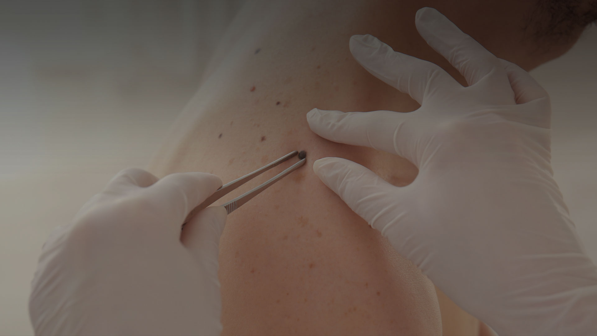 Dermatosurgery | Umhlanga & Ballito, Durban | Dr Ishaan Ramkisson