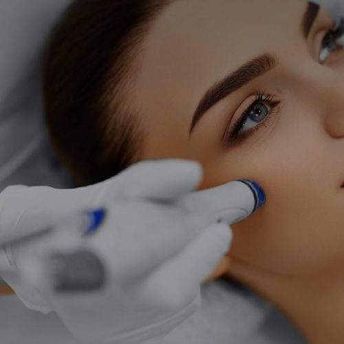 Limelight Laser Facial