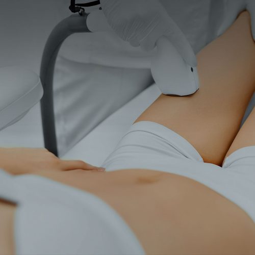 Laser Vein Therapy