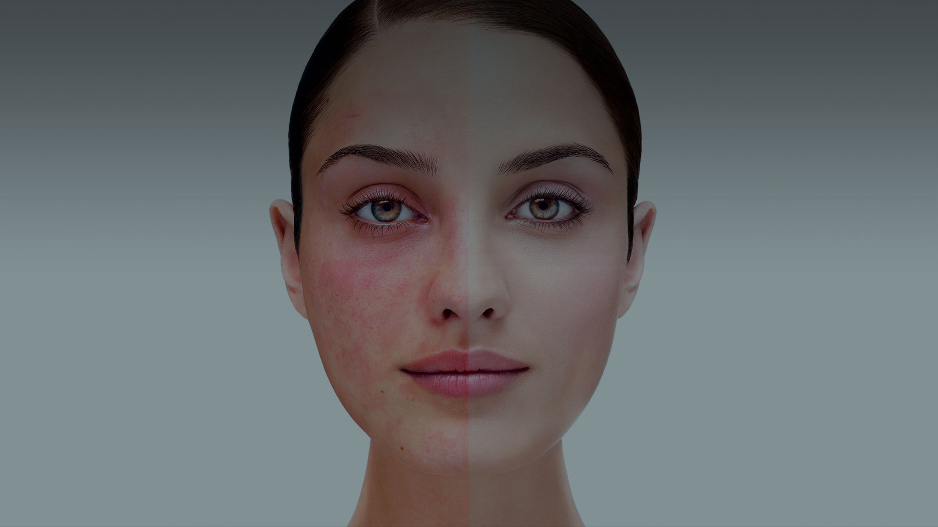 Redness and Rosacea | Umhlanga & Ballito, Durban | Dr Ishaan Ramkisson
