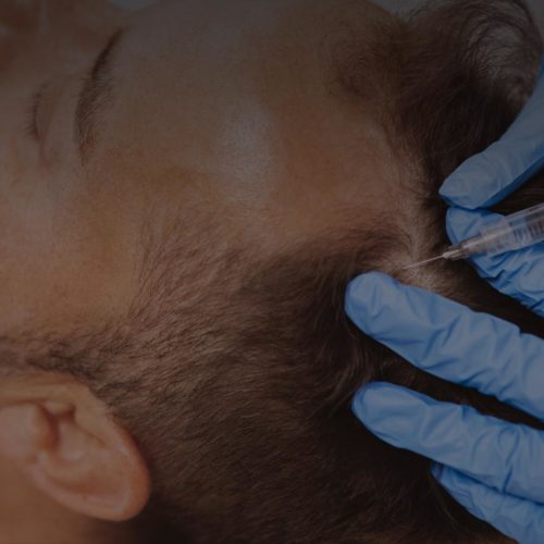 Hair Rejuvenation Treatment
